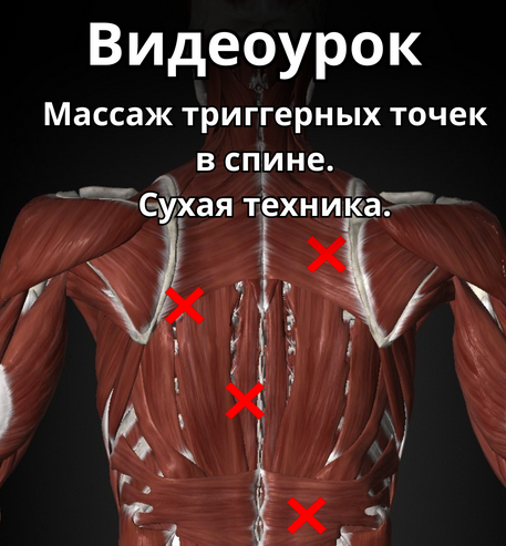 1711005656560.png
